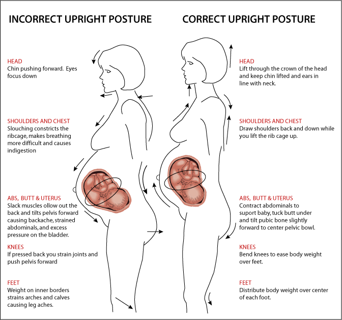 Pregnancy Posture